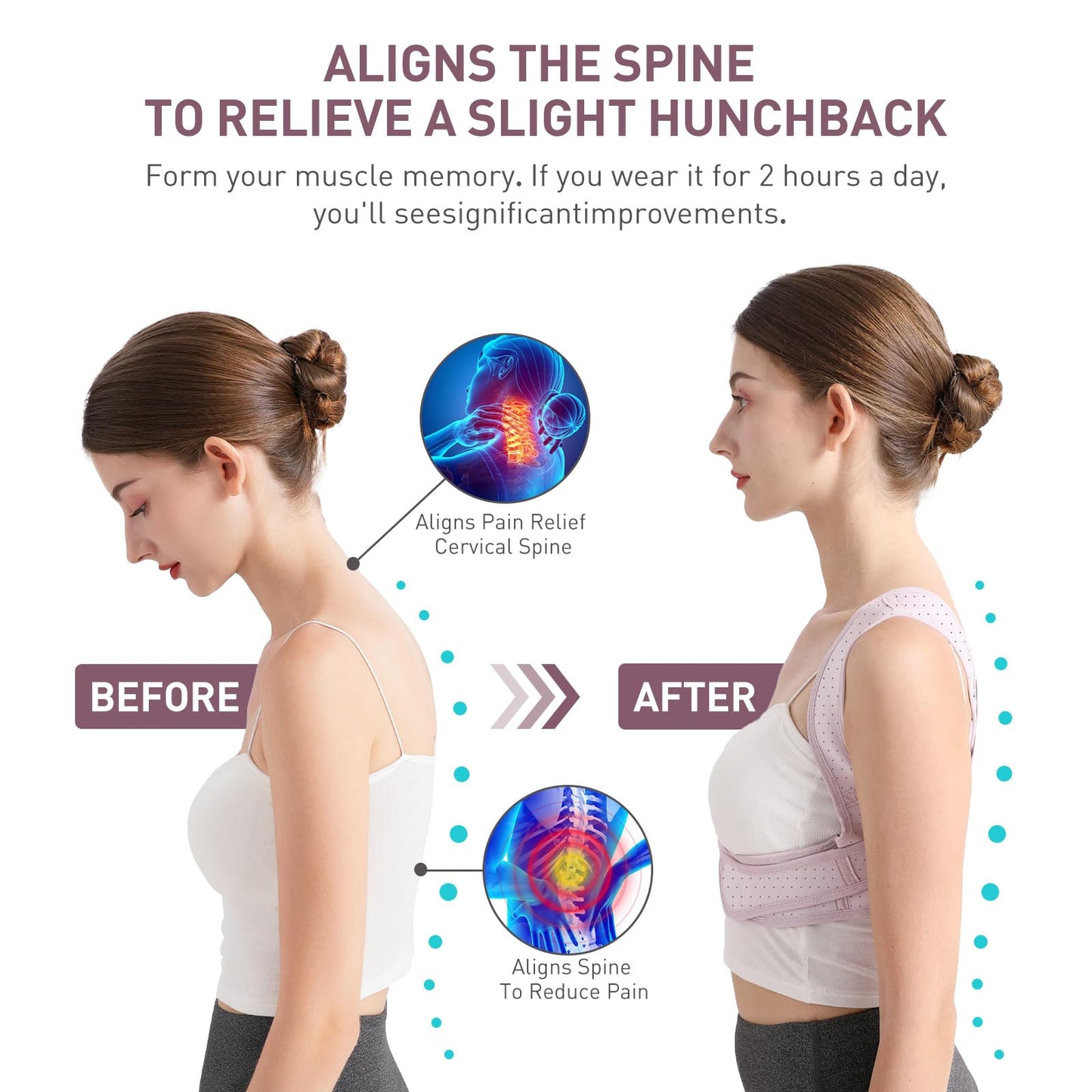 NLNYCT Posture Corrector For Women, Adjustable Back Brace For Posture, Back Posture Corrector Providing Pain Relief From Lumbar, Neck, Shoulder, And Clavicle, Back (S/M Upper Waist 27-35 Inch)