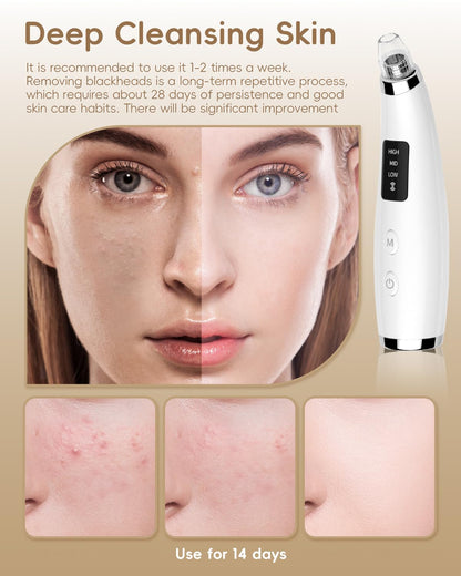 Facial Pore Blackhead Remover Vacuum - Fore Cleaner and Blackhead Extractor with 3 Adjustable Suction Levels - 5 Probes - Pore Vacuum Kit for Women&Men (White)