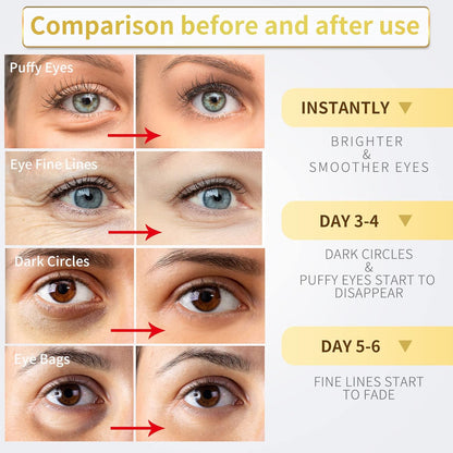 24K Gold Under Eye Patches - 60 Pack for Puffy Eyes, Dark Circles, Bags & Wrinkles with Collagen & Hyaluronic Acid