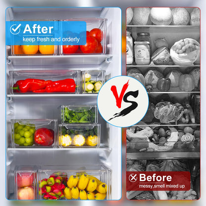 KUMD 10-Pack Clear Fridge Organizer Bins with Lids, Stackable Refrigerator Storage Containers, BPA-Free with Drain Tray & Anti-Slip Base for Fruits, Veggies, Drinks