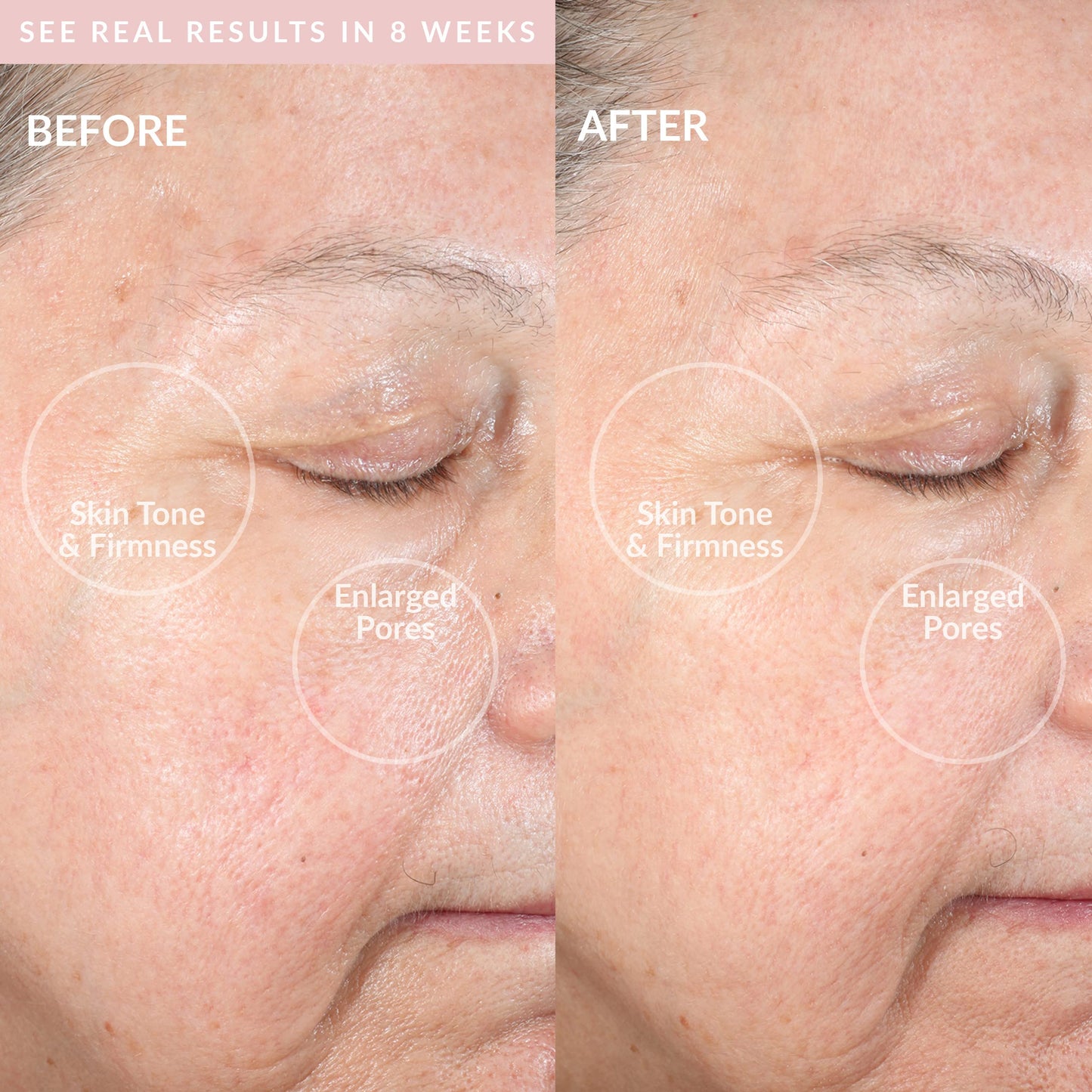 PMD Beauty Clean Pro OB - Smart Facial Cleansing Device